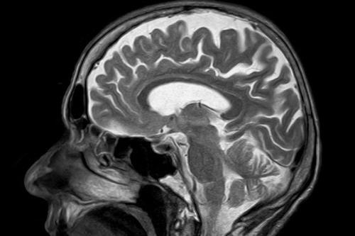 Brain s perpetuation nucleus likewise clew for real-time decision-making